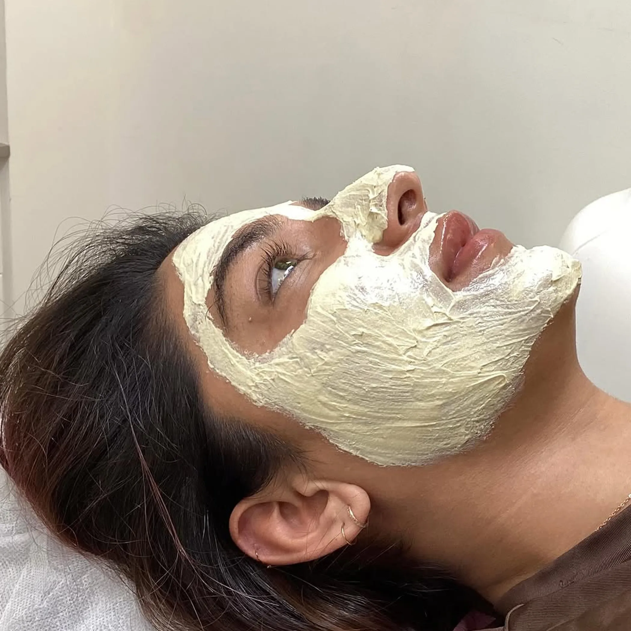 skin treatment for pigmentation management